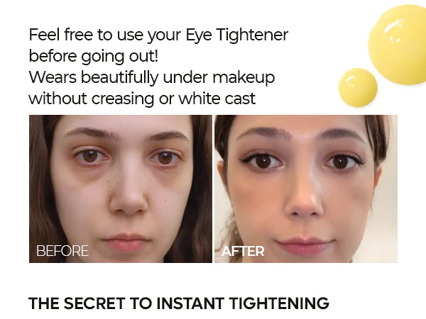 DR.MELAXIN EYEPHALT RETINOL EYEBAG CREAM Krem pod oczy z retinolem 10 g - Image 7